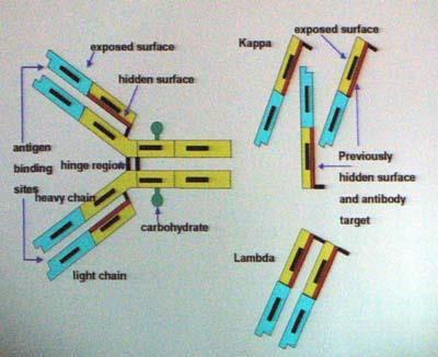 Free Light Chain Assay: measures levels