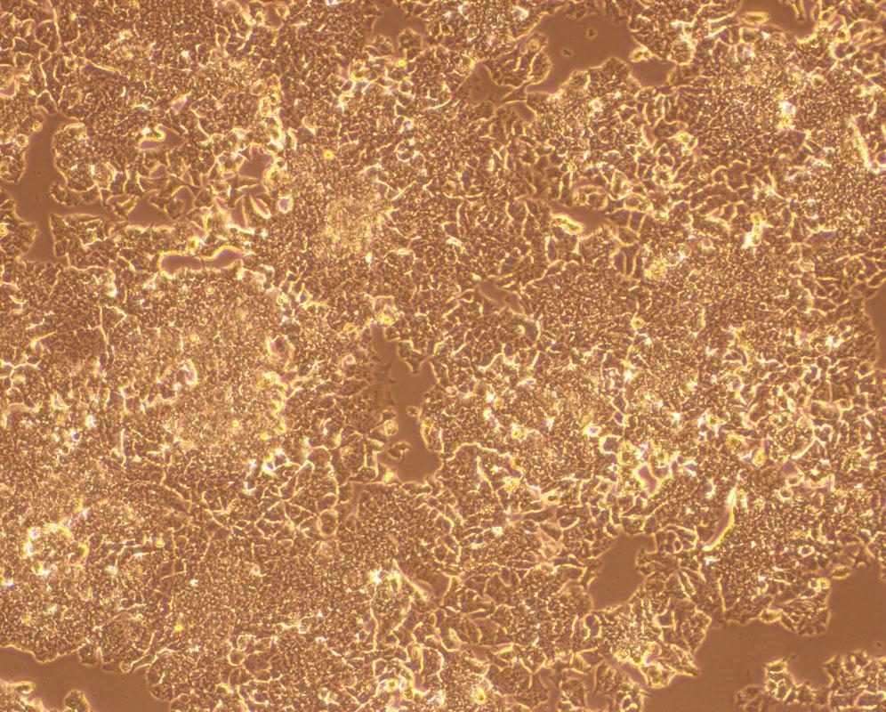 B (A) PC12 cells cultured in Ham's F12K containing 5% fetal calf serum and 10% horse serum on collagen coated plates, stimulated with 10ng/mL NGF for 6 days; (B) Unstimulated PC12 cells cultured in