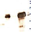 electrophoresis ligation into pgex-2tk CB/pGEX-2TK colony-pcr 1. Template a 2.