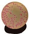 Quantitative test of Enterobacteria and other Gram-negative bacteria 1. Obtain the sample aseptically. 2.