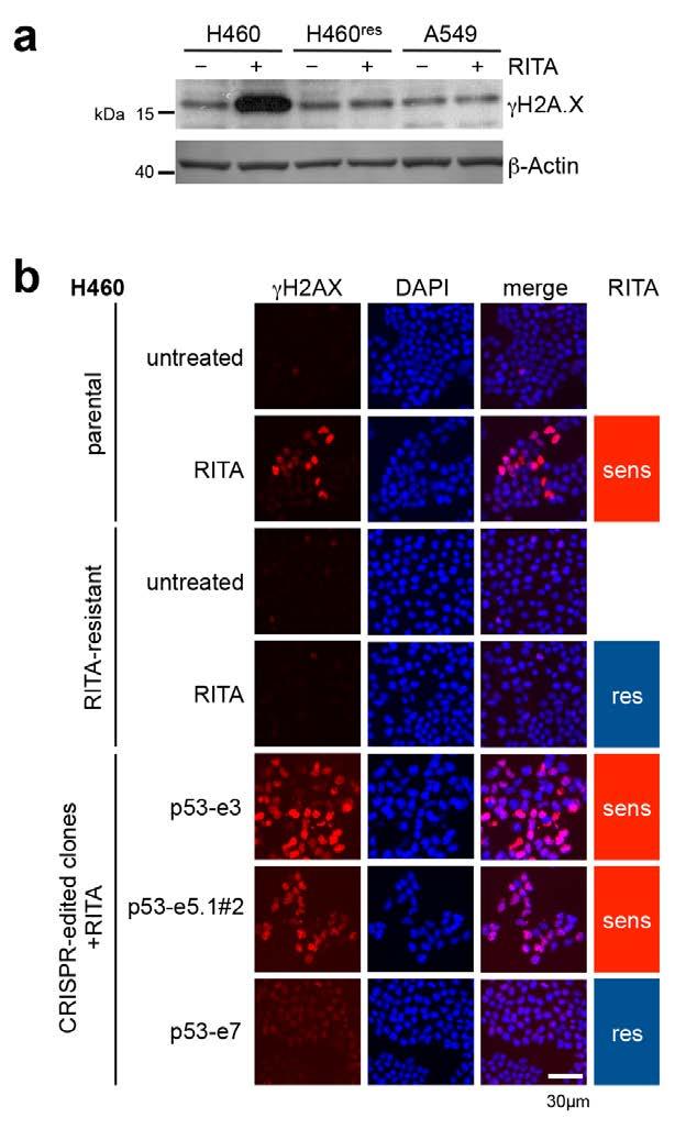 Supplementary Figure 9. Induction of γh2a.x after a 16 hour treatment with 1 µm RITA in sensitive but not RITA resistant H460 or primary resistant A549 cells.