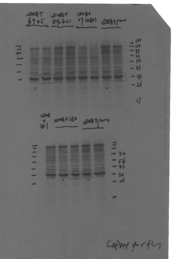 Bottom gel: Two boxed bands (left, shrna270; right, control) are cropped and presented in Fig. 2. Right: Anti-GAPDH immunoblotting reveals similar protein loading.