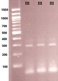 SCCmec PCR Primers Type I-F = 5 - gct tta aag agt gtc gtt aca gg -3 Type I-R = 5 - gtt ctc tca tag tat gac gtc c -3 Type II-F = 5 - cgt tga aga tga tga agc g -3 Type II-R = 5 - cga aat caa tgg tta