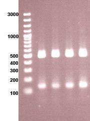 Spa PCR Primers 5 -tgtaaaacgacggccagtgctaaaaagctaaacgatgc-3 5 -caggaaacagctatgaccccaccaaatacagttgtacc-3 PCR condition