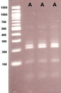Rsa I digested-spa PCR product