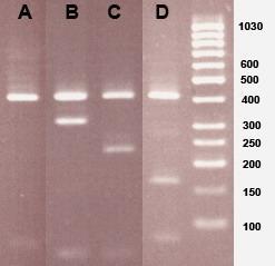 Alu I digested-coa PCR product Pattern A = 1 strain
