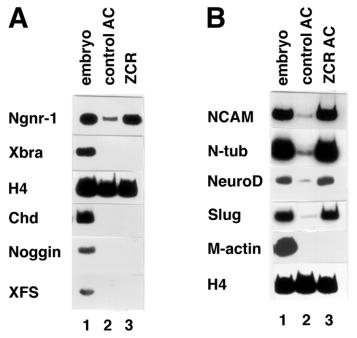 584 K. Mizuseki and others Fig. 5. RT-PCR analysis of Zic-r1 (ZCR)-injected animal caps (AC) stage 12 (A) and stage 17 (B). Ngnr-1, Xngnr-1; XFS, Follistatin; H4, histone H4.
