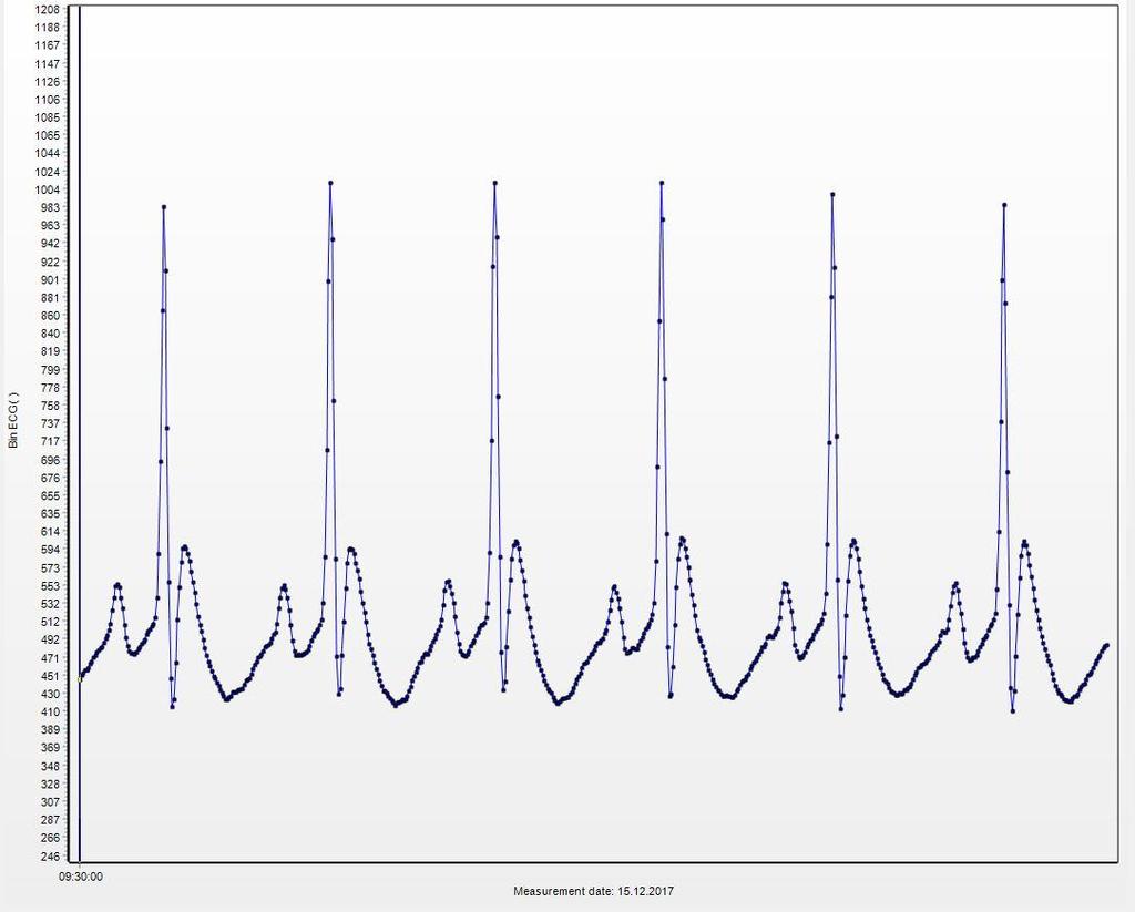 Star Oddi Device Data collection ECG derived heart rate, including data verification The heart rate is derived from a leadless single channel ECG.