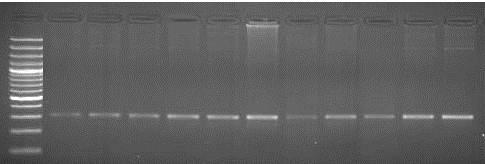 β-casein Gene - The polymorphism of this gene was detected using PCR-SSCP technique.