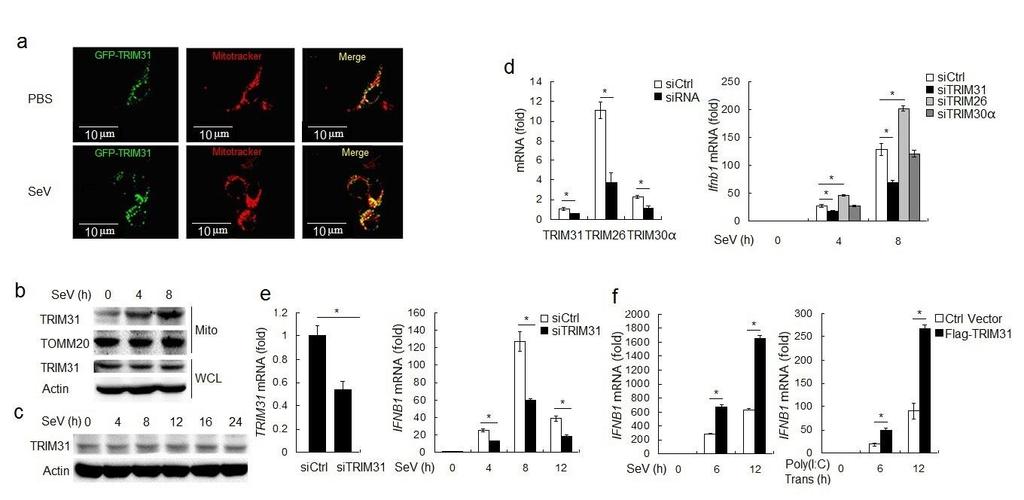 Supplementary Figure 1 TRIM31 is recruited to mitochondria after infection with SeV. (a) Confocal microscopy of TRIM31-GFP transfected into HEK293T cells for 24 h followed with SeV infection for 6 h.