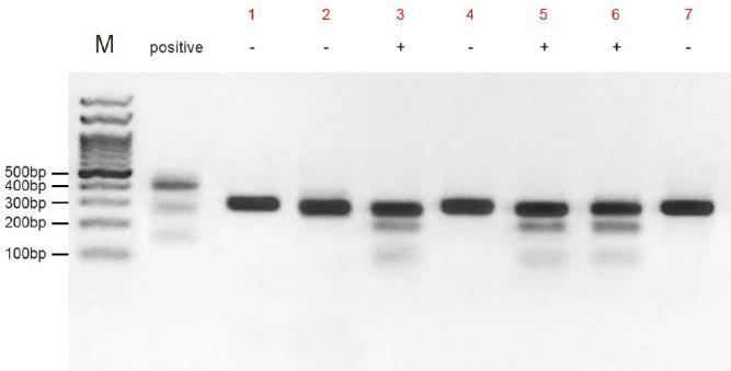 Digest Hybrid DNA and Gel Analysis Annealed PCR products 2-5 μl 5 Detection buffer 2 μl Detection enzyme 1 μl Add ddh 2 O to 10 μl Incubate at 45 C for 15-20 min (no longer that 30 min), and then add