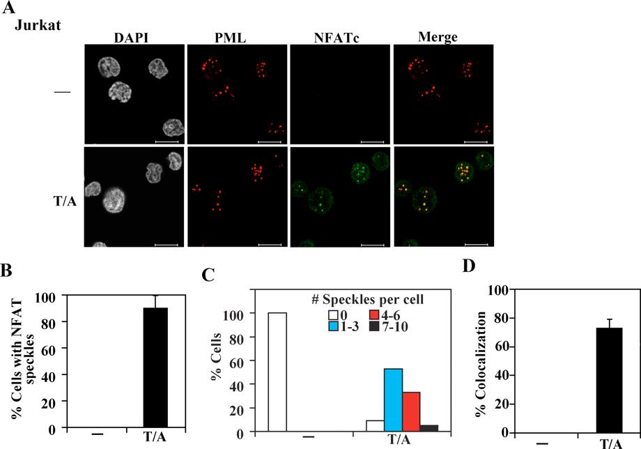Luo et al. Supplemental Figure 1 Supplemental Figure 1. Co-localization of NFATc and PML in PODs. (A) Nuclear co-localization of NFATc and PML in Jurkat cells.