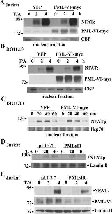 Luo et al. Supplemental Figure 2 Supplemental Figure 2. PML-dependent nuclear presence of NFATc and NFATp. (A, B, C) PML overexpression did not increase nuclear localization of NFAT.