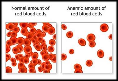 Causes of anemia?
