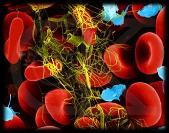How the body repairs itself Stopping blood loss: Fibrinogen (plasma protein) is converted