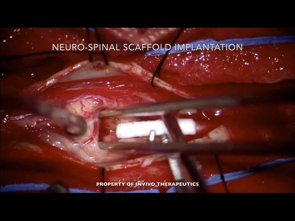 First Neuro-Spinal Scaffold