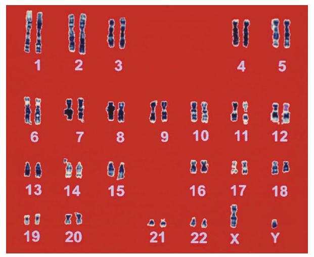 Karyotype of Human Genome What do you notice about the