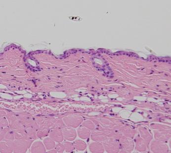 Scale bar, 1 μm. (c) Relative total collagen content in the back skin assessed by total collagen assay.