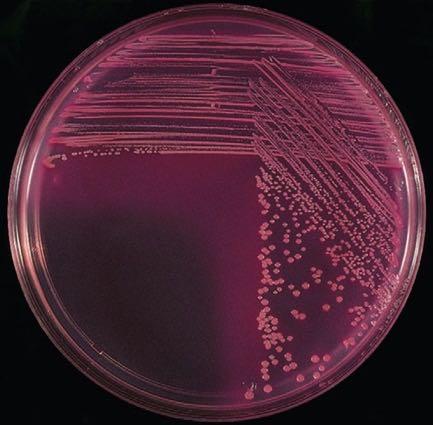 A B A, Lactose-fermenting Escherichia/Citrobacter-like organisms growing on