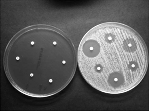 SUSCEPTIBILITY TESTING After a pathogen is cultured, its sensitivity to specific