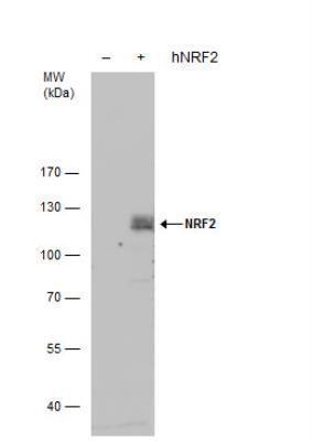 The HRPconjugated anti-rabbit IgG antibody (NBP2-19301) was used to detect the primary antibody, and the signal was developed with Trident ECL plus-enhanced. Page 3 of 6 v.20.