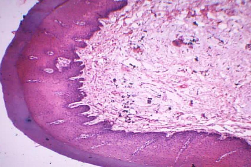 mucosa Fig: 7.1.