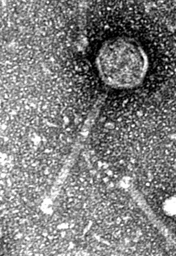 50 nm Figure S1. P. acnes phage morphology.