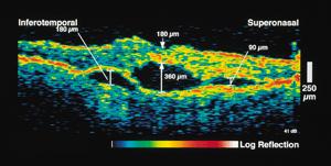 Medical Application of Photonics Clinical Imaging