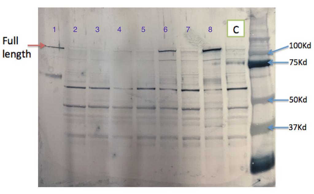 Figure.3. Western blot, using second rabbit polyclonal TERT antibody, for proteins extracted from Caco-2 cell samples treated with 8 Nutraceutical compounds and untreated one (Control).